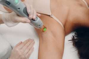 treatment memutihkan ketiak