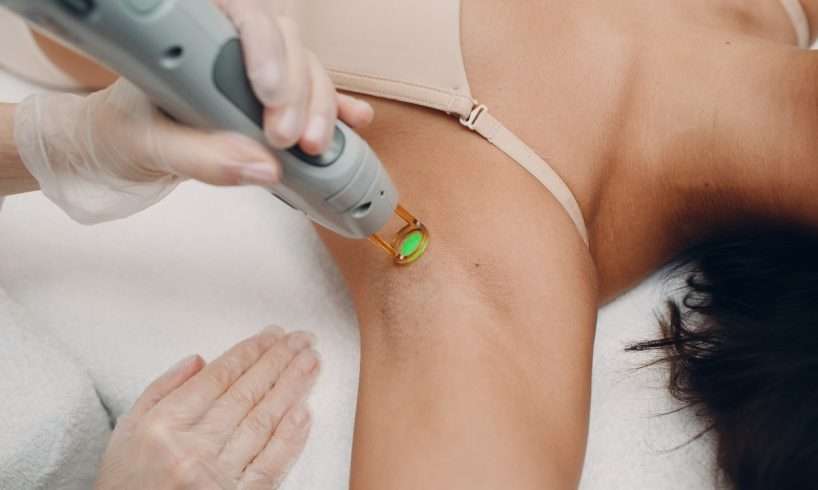 treatment memutihkan ketiak